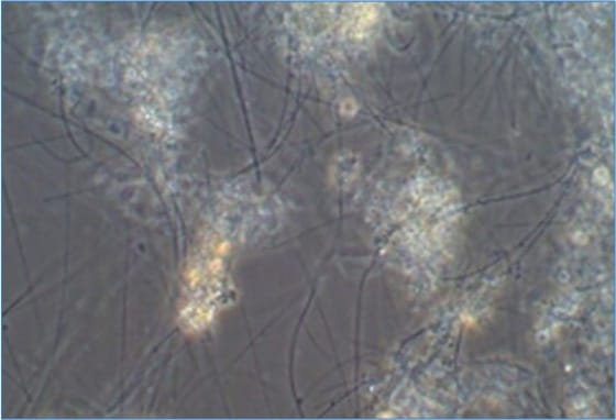 バルキングの原因となる糸状性細菌（400倍）